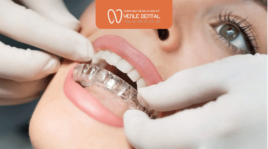 niềng răng invisalign